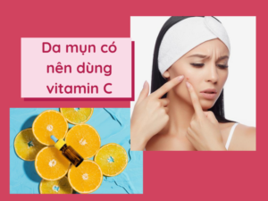 67AqnYNI-44-da-mun-co-nen-dung-vitamin-c